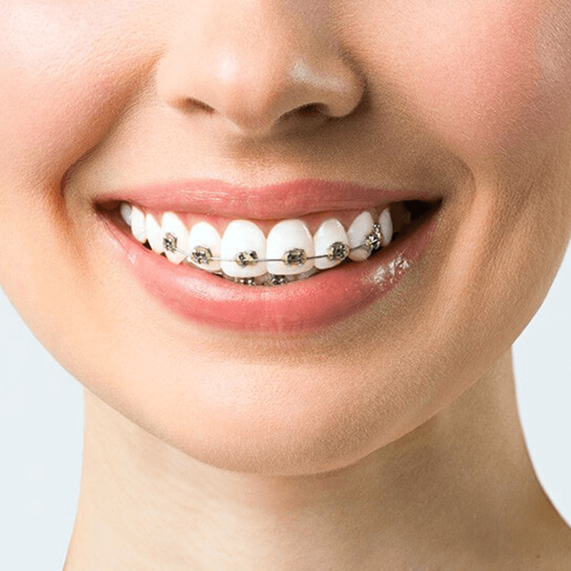 Ortho Dictionary
